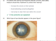 (Q&A) LPN Med Surg Proctored Exam2 146 Questions