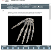 Musculoskeletal-ATI NCLEX RN Exam Prep 25 Questions