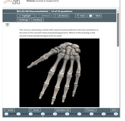 Musculoskeletal-ATI NCLEX RN Exam Prep 25 Questions