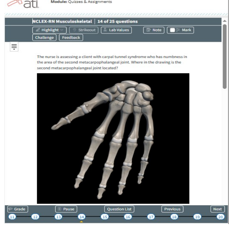 Musculoskeletal-ATI NCLEX RN Exam Prep 25 Questions