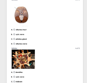 New Version: Anatomy and Physiology: Parts of the Brain Q&A 2026