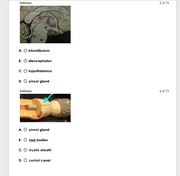 New Version: Anatomy and Physiology: Parts of the Brain Q&A 2026