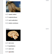 New Version: Anatomy and Physiology: Parts of the Brain Q&A 2026