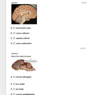 New Version: Anatomy and Physiology: Parts of the Brain Q&A 2026
