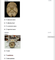 New Version: Anatomy and Physiology: Parts of the Brain Q&A 2026